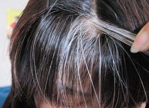 白发原因有哪些 中医养发 白发转黑发必须注意这4点