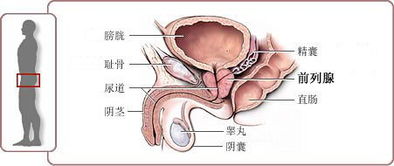 慢性前列腺炎的原因都有什么