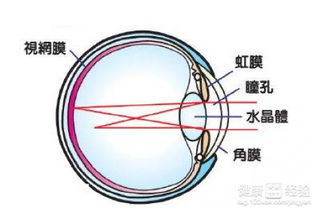 三大因素致散光教你避免散光的方法