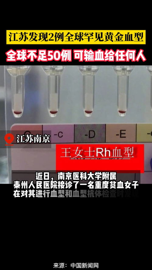 江苏发现2例全球罕见黄金血型RhNULL,全球不足50例 