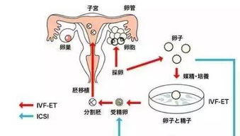 泰国试管婴儿移植次数有限制吗