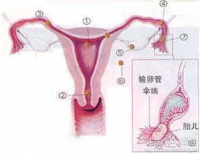 宫外孕多少天出症状