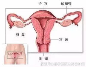 上环 还是不上环 女人必看