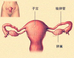 盆腔粘连要怎么检查呢 