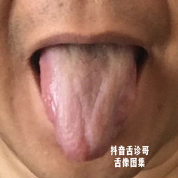 你知道舌头吗(你知道舌头长什么样)