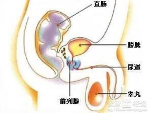 得了急性前列腺炎怎么办