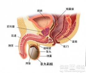 为什么不建议前列腺手术