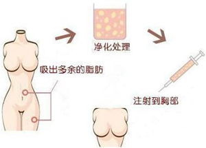 脂肪乳不建议单瓶使用吗