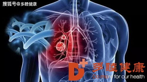 为什么越来越多的人选择去日本治疗肺癌