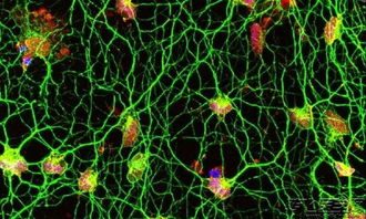 重磅研究 人类皮肤细胞可直接转化为运动神经元 