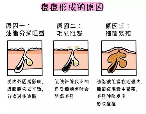 新依美护肤 痘痘一波未平一波又起 如何改善痘痘肌