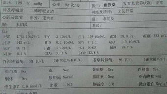 富士康集团的体检标准是什么 