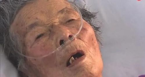四川93岁老人被火钳烫出两个洞,直言是儿媳所为,究竟是怎么回事