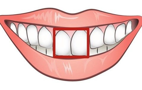 大连牙元素口腔怎么样 大连牙元素口腔种植牙价格贵吗