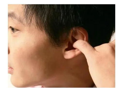 耳朵出现4种变化,可能是疾病的信号,别不当回事