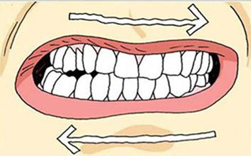 磨牙是什么原因？睡觉磨牙是什么原因