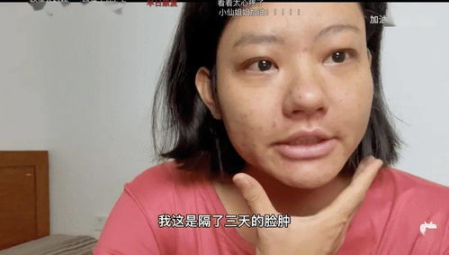 29岁女博主患上尿毒症 这个坏习惯害了我 医生劝告 这种病越来越多