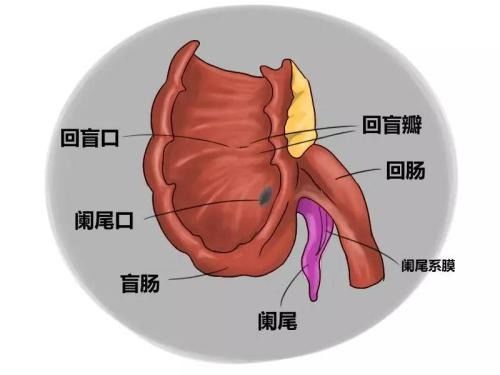 急性阑尾炎如何早期发现