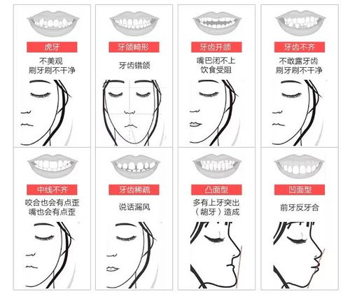 倒计时4天 牙齿种植 牙齿矫正市民可申领这些补贴