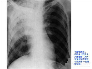 必看 100张放射美图让你学会X线