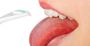 舌苔为什么发白 可能是这些疾病的征兆