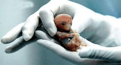 当实验室里的人类胚胎长出心脏,是进步还是灾难 