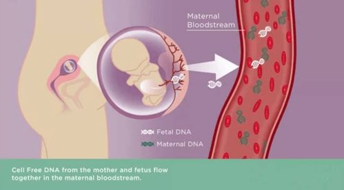 干货满满 关于孕妇外周血胎儿游离DNA产前筛查