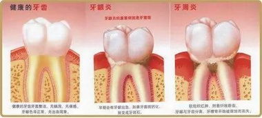 你是否被牙龈出血困扰 这家店带你进入无痛洁牙新时代 