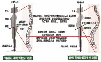 跑步外八字怎么纠正 