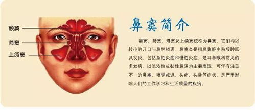 老人左眼胀痛 视物有重影 竟是鼻窦囊肿的 锅