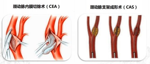 不忘初心 共筑健康中国梦 血管健康中国行活动启动啦