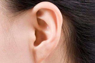 耳朵出现这些变化竟是疾病征兆 