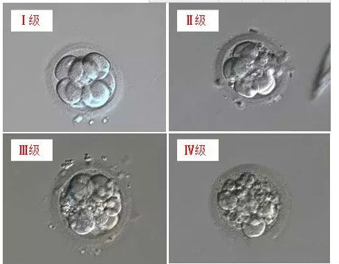 试管婴儿如何避免胚胎碎片率高的问题？