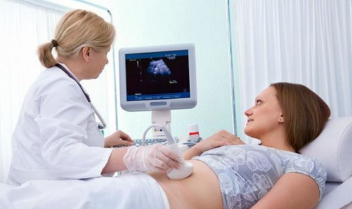 孕期检查 孕囊无回声,是什么情况