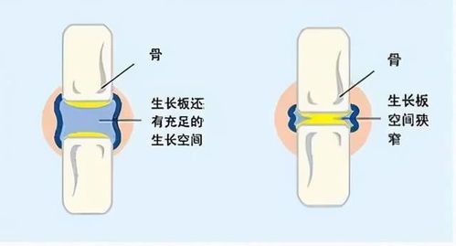 滨州市人民医院五一举办矮小症义诊,免费测骨龄