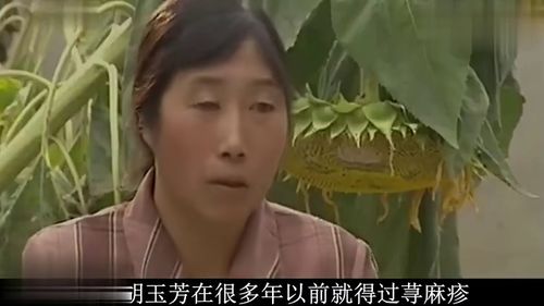 甘肃女子 天生异相 ,手臂之上长出神秘字迹,医生结论惊呆众人 