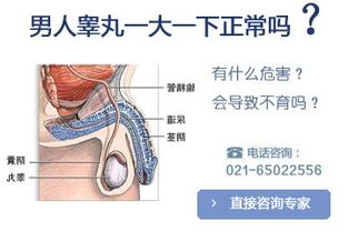 睾丸发育不良的治疗费用要多少