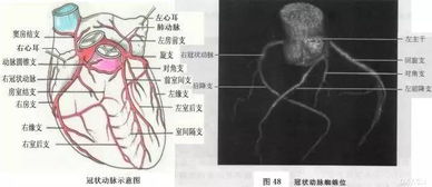 看懂心血管 CT 解剖 只要10 分钟 