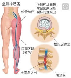 颈肩腰腿痛 摸骨 整脊