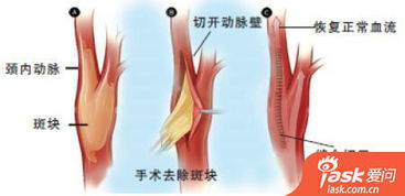 经验分享 经验交流 经验总结 爱问经验 中文互动问答平台 