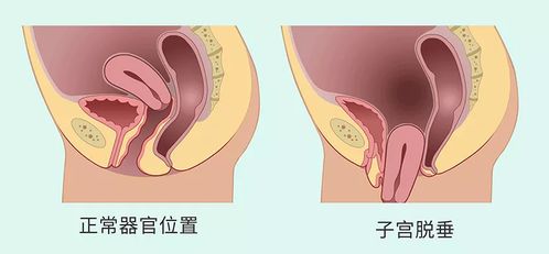 用口把那个弄出来了 隔着一层肉壁两根