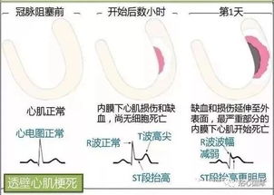 图解版心血管系统知识汇总,值得收藏