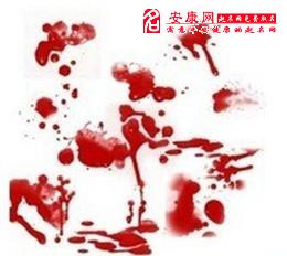 梦见用筷子杀人不见血是什么意思梦到用筷子杀人不见血好不好