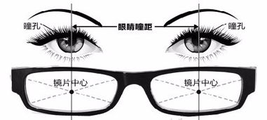 昨天配了眼镜,左眼275度,右眼325度 戴眼镜后发现斜视两侧,看到的物体是有些扁的,从下往上看, 