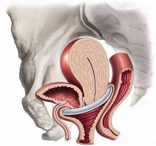子宫下垂什么原因(子宫下垂有什么办法恢复正常)