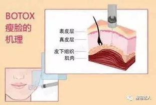 打完瘦脸针后意外怀孕,医生劝她这样做 