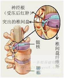 老年人手麻,头晕,面色苍白吃什么调理