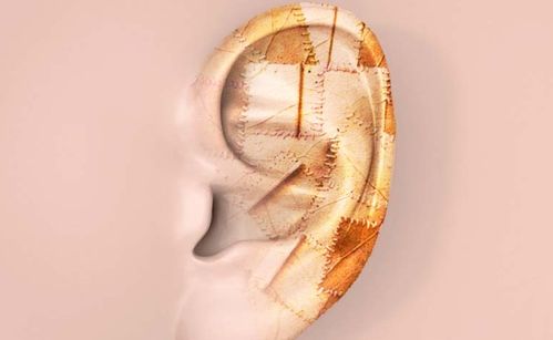 耳朵缺一块怎么修补 部分耳再造手术大全