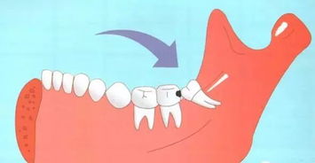 一颗牙齿的7种命运 