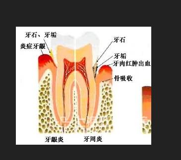 牙龈痛 搜狗百科 